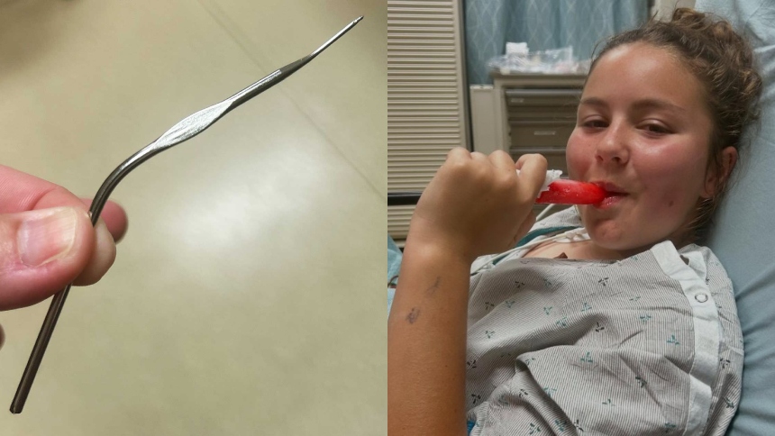 En un desafortunado accidente que ha dejado muchos con la boca abierta una niña de 12 años de Oceanside, California (EEUU), sufrió una lesión inesperada mientras buscaba un audífono perdido en su hogar.  