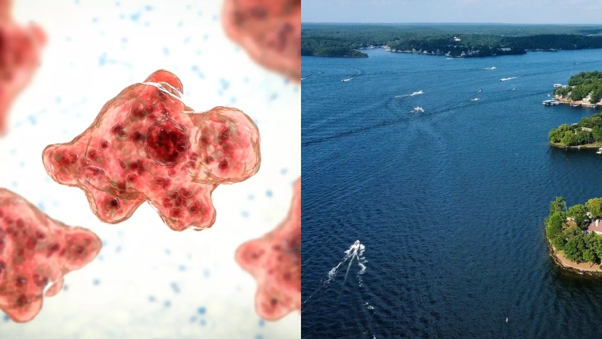 Un residente de Missouri (EEUU) falleció tras infectarse con Naegleria fowleri, una ameba microscópica conocida como la “devoradora de cerebros”.  
