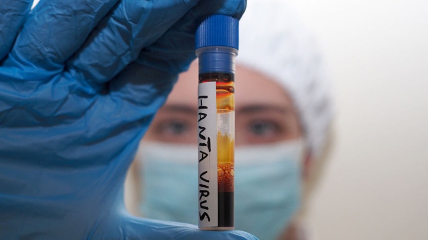 Hantavirus